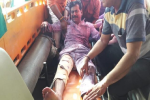  लखीमपुर के बीजेपी विधायक योगेश वर्मा को मारी गोली, घायल,  हमलावर कार में सवार थे